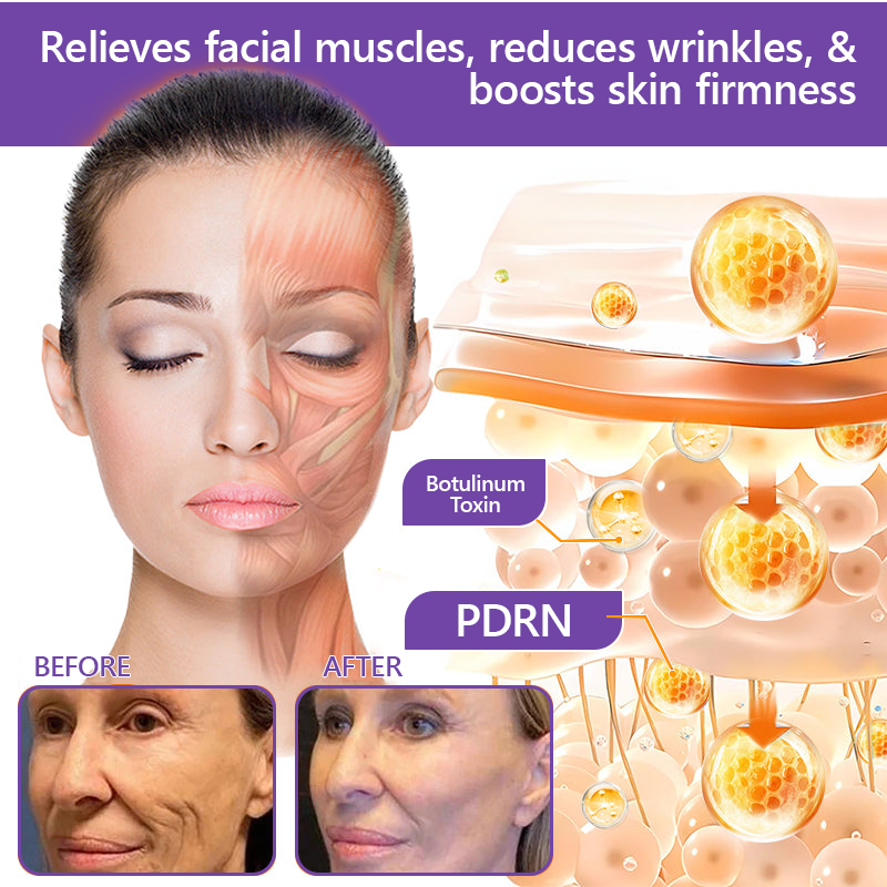 HISKIN® PDRN Multi-Peptide Massaging Body Roller Cream- ✨𝐀𝐧𝐭𝐢-𝐚𝐠𝐢𝐧𝐠, Hydrating, Skin Firming & Lifting, Skin Repair, Even Tone, Acne and Dark Spot Treatment, Wart and Mole Removal, and Psoriasis Relief