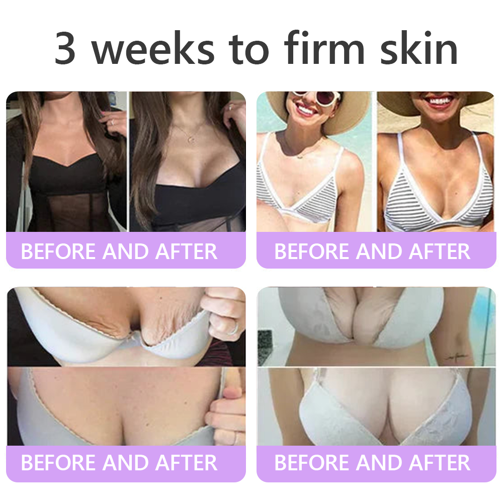𝐇𝐈𝐒𝐊𝐈𝐍® 𝐏𝐃𝐑𝐍 𝐌𝐮𝐥𝐭𝐢-𝐏𝐞𝐩𝐭𝐢𝐝𝐞 𝐌𝐚𝐬𝐬𝐚𝐠𝐢𝐧𝐠 𝐁𝐨𝐝𝐲 𝐑𝐨𝐥𝐥𝐞𝐫 𝐂𝐫𝐞𝐚𝐦- Anti-aging, Hydrating, Skin Firming & Lifting, Skin Repair, Even Tone, Acne and Dark Spot Treatment, Wart and Mole Removal, and Psoriasis Relief.