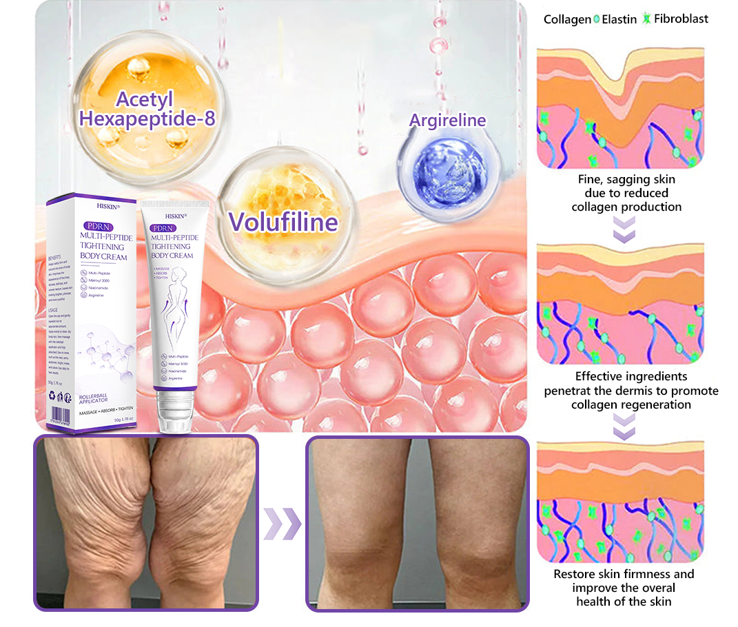 HISKIN® PDRN Multi-Peptide Massaging Body Roller Cream- ✨𝐀𝐧𝐭𝐢-𝐚𝐠𝐢𝐧𝐠, Hydrating, Skin Firming & Lifting, Skin Repair, Even Tone, Acne and Dark Spot Treatment, Wart and Mole Removal, and Psoriasis Relief