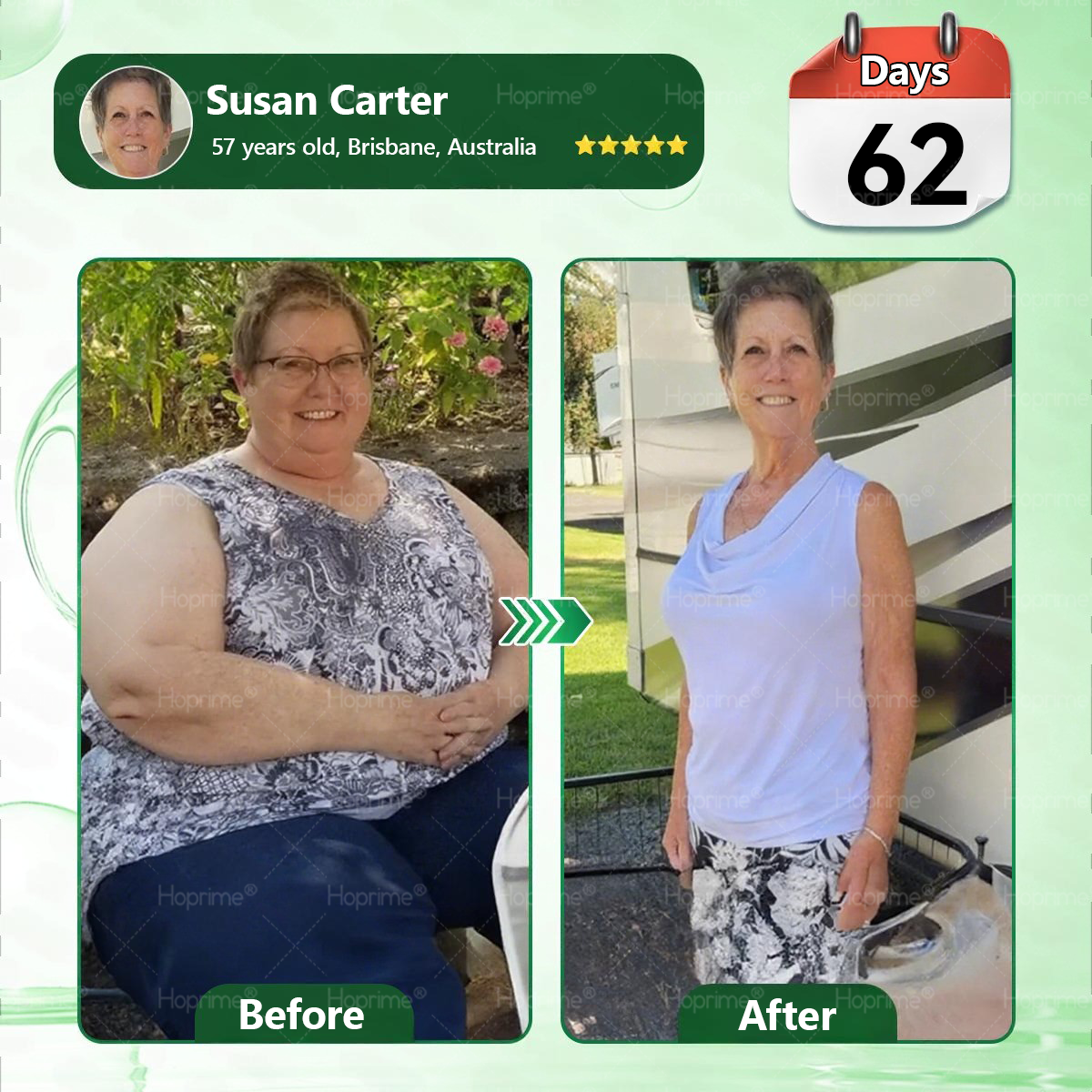 𝑶𝒇𝒇𝒊𝒄𝒊𝒂𝒍 𝑺𝒕𝒐𝒓𝒆 | 💫💫𝑯𝙤𝒑𝐫𝒊𝙢𝒆®𝑴𝒐𝒓𝒊𝒏𝒈𝗮 & 𝗕𝗲𝗿𝗯𝗲𝗿𝙞𝙣𝙚 × 𝙉𝘼𝐃+ 𝟏𝟎-𝐢𝐧-𝟏 𝗔𝗱𝘃𝗮𝗻𝗰𝙚𝙙 𝙉𝙖𝙣𝙤 𝙈𝙞𝙘𝙧𝙤𝙣𝙚𝙚𝐝𝐥𝐞 𝐏𝐚𝐭𝙘𝙝🇦🇺(𝐉𝐮𝐬𝐭 𝐨𝐧𝐜𝐞 𝐚 𝐝𝐚𝐲, 𝐯𝐢𝐬𝐢𝐛𝐥𝐞 𝐜𝐡𝐚𝐧𝐠𝐞𝐬 𝐢𝐧 𝟕 𝐝𝐚𝐲𝐬） ✅ 𝐅𝐨𝐫 𝐨𝐛𝐞𝐬𝐢𝐭𝐲, 🅛🅞🅞🅢🅔 🅢🅚🅘🅝,𝐝𝐢𝐚𝐛𝐞𝐭𝐞𝐬, 𝐬𝐥𝐞𝐞𝐩 𝐚𝐩𝐧𝐞𝐚, 𝐣𝐨𝐢𝐧𝐭 𝐢𝐬𝐬𝐮𝐞𝐬, 𝐚𝐧𝐝 𝐦𝐨𝐫𝐞