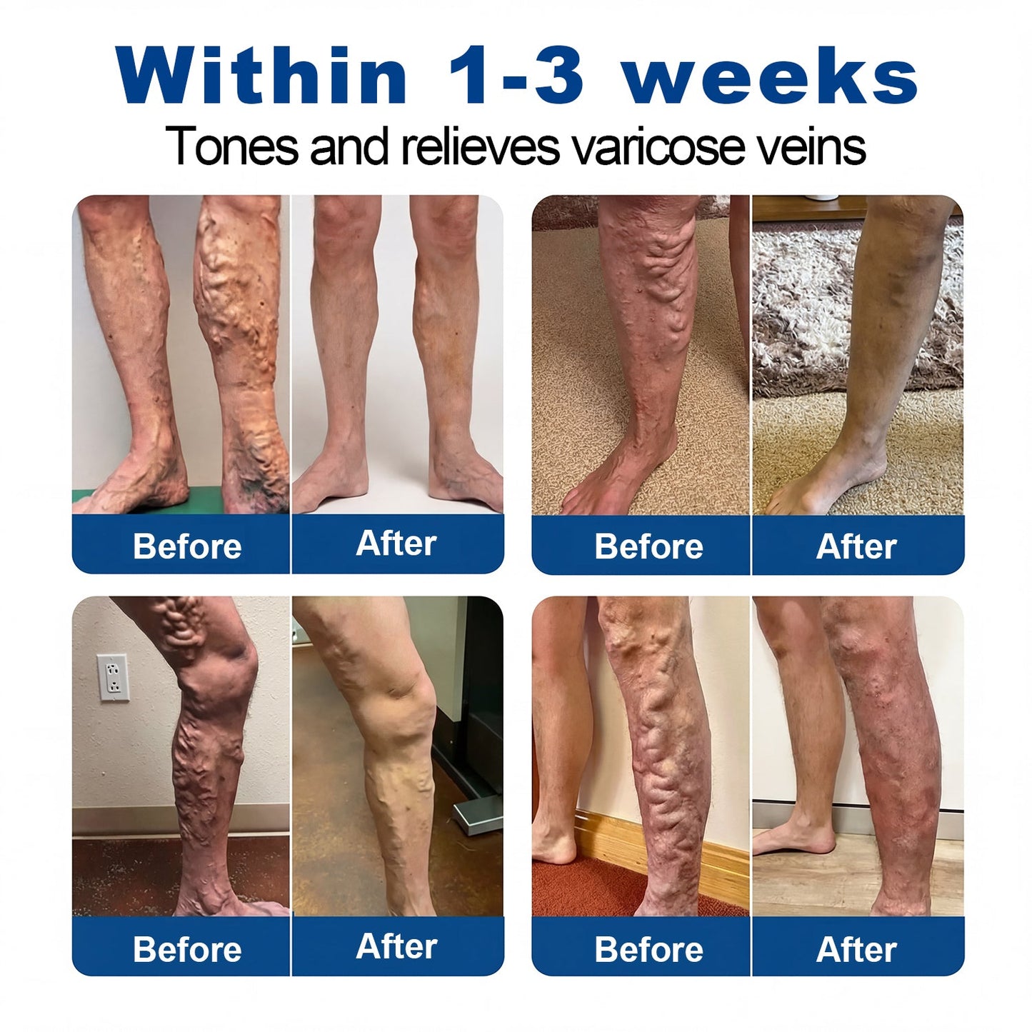 🇦🇺👨‍⚕️✅✅Lexasky® VEIN EASE MICRONEEDLE CARE PATCH⚡Instant Relief, Long-Term Results