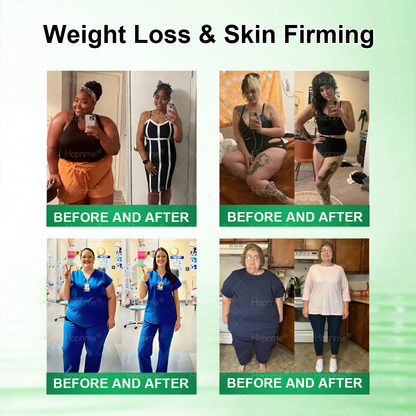 𝐏𝐡𝐲𝐬𝐢𝐜𝐢𝐚𝐧-𝐅𝐨𝐫𝐦𝐮𝐥𝐚𝐭𝐞𝐝 🧑‍⚕️| Hoprime® Moringa · Berberine × AMPK+ 10-in-1 Metabolic Support Nano Microneedle Patch — ✅ 𝐄𝐱𝐩𝐞𝐫𝐢𝐞𝐧𝐜𝐞 𝐕𝐢𝐬𝐢𝐛𝐥𝐞 𝟕-𝐃𝐚𝐲 𝐑𝐞𝐬𝐮𝐥𝐭𝐬 🍉
