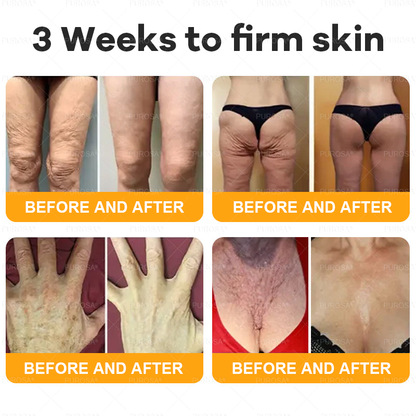 Made and Shipped from AU 🌸🌸🌸 PUROSA® BEE VENOM Skin Restoration Cream 🔥 LAST DAY 80% OFF！