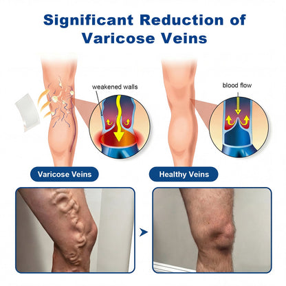 🇦🇺👨‍⚕️✅✅Lexasky® VEIN EASE MICRONEEDLE CARE PATCH⚡Instant Relief, Long-Term Results