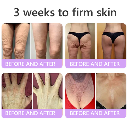 HISKIN® PDRN Multi-Peptide Massaging Body Roller Cream- ✨𝐀𝐧𝐭𝐢-𝐚𝐠𝐢𝐧𝐠, Hydrating, Skin Firming & Lifting, Skin Repair, Even Tone, Acne and Dark Spot Treatment, Wart and Mole Removal, and Psoriasis Relief