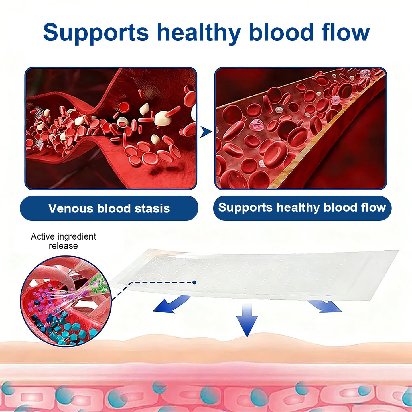 🇦🇺👨‍⚕️✅✅Lexasky® VEIN EASE MICRONEEDLE CARE PATCH⚡Instant Relief, Long-Term Results