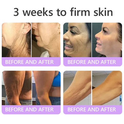 HISKIN® PDRN Multi-Peptide Massaging Body Roller Cream- ✨𝐀𝐧𝐭𝐢-𝐚𝐠𝐢𝐧𝐠, Hydrating, Skin Firming & Lifting, Skin Repair, Even Tone, Acne and Dark Spot Treatment, Wart and Mole Removal, and Psoriasis Relief
