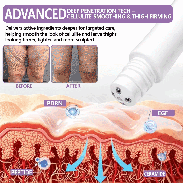 𝐇𝐈𝐒𝐊𝐈𝐍® 𝐏𝐃𝐑𝐍 𝐌𝐮𝐥𝐭𝐢-𝐏𝐞𝐩𝐭𝐢𝐝𝐞 𝐌𝐚𝐬𝐬𝐚𝐠𝐢𝐧𝐠 𝐁𝐨𝐝𝐲 𝐑𝐨𝐥𝐥𝐞𝐫 𝐂𝐫𝐞𝐚𝐦- Anti-aging, Hydrating, Skin Firming & Lifting, Skin Repair, Even Tone, Acne and Dark Spot Treatment, Wart and Mole Removal, and Psoriasis Relief.