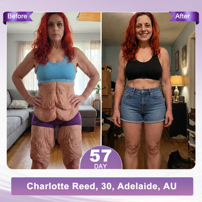 𝐇𝐈𝐒𝐊𝐈𝐍® 𝐏𝐃𝐑𝐍 𝐌𝐮𝐥𝐭𝐢-𝐏𝐞𝐩𝐭𝐢𝐝𝐞 𝐌𝐚𝐬𝐬𝐚𝐠𝐢𝐧𝐠 𝐁𝐨𝐝𝐲 𝐑𝐨𝐥𝐥𝐞𝐫 𝐂𝐫𝐞𝐚𝐦- Anti-aging, Hydrating, Skin Firming & Lifting, Skin Repair, Even Tone, Acne and Dark Spot Treatment, Wart and Mole Removal, and Psoriasis Relief.