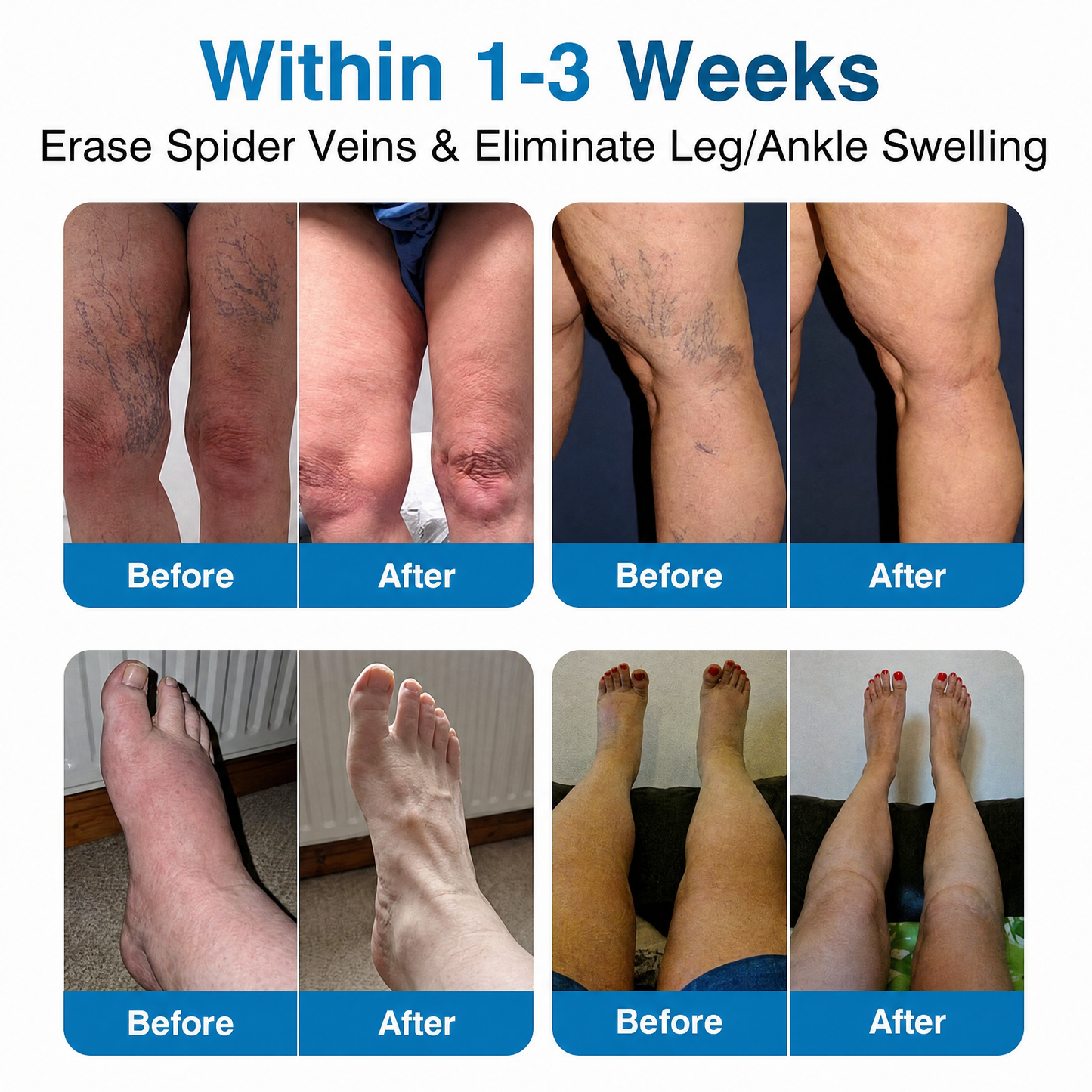 Lexasky® VEIN EASE MICRONEEDLE CARE PATCH⚡Instant Relief, Long-Term Results