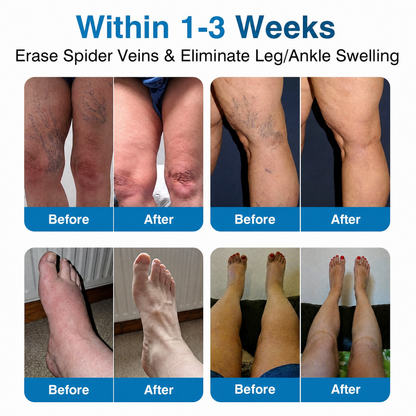 Lexasky® VEIN EASE MICRONEEDLE CARE PATCH⚡Instant Relief, Long-Term Results